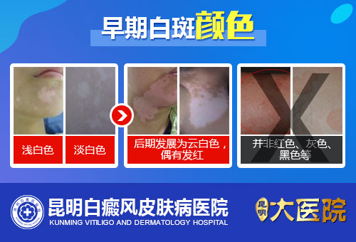 辨别皮肤白斑的早期症状