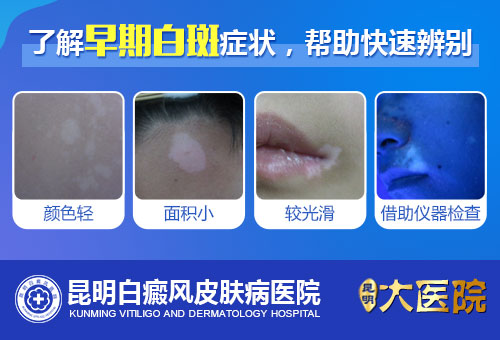 辨别皮肤白斑的早期症状